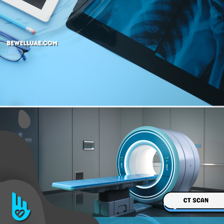 CT Scan Without Contrast 